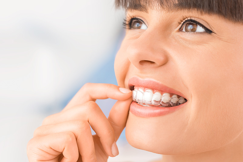 Invisalign in Excelsior