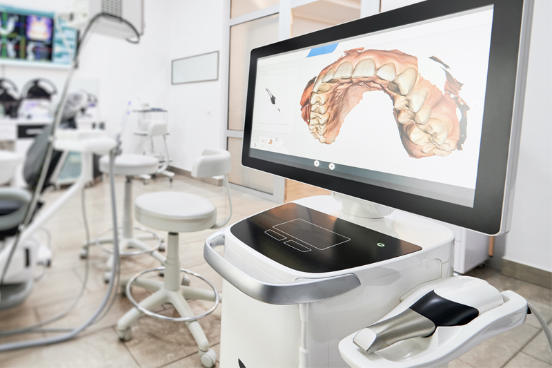 Itero Intra-Oral Scanner in Excelsior